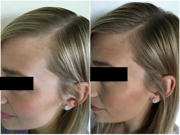 Hair Strengthening Spray