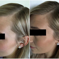 Hair Strengthening Spray