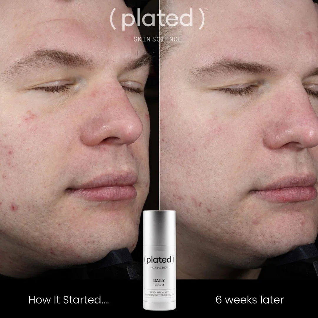 Plated Daily Serum