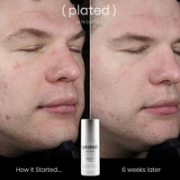 Plated Daily Serum